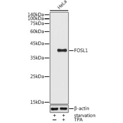 FOS Like Antigen 1 (FOSL1) Antibody