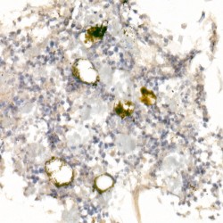 Platelet Glycoprotein IX (GP9) Antibody