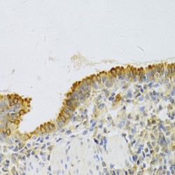 Proliferation Associated Protein 2G4 (PA2G4) Antibody