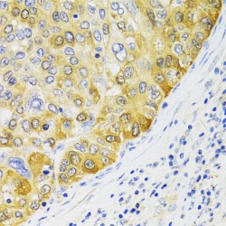 Proliferation Associated Protein 2G4 (PA2G4) Antibody
