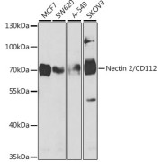 Western blot analysis of various lysates using Nectin 2/CD112 Antibody at 1/1000 dilution. Secondary antibody: HRP-conjugated Goat anti-Rabbit IgG (H+L) at 1/10000 dilution. Lysates/proteins: 25 µg per lane. Blocking buffer: 3% nonfat dry milk in TBST.