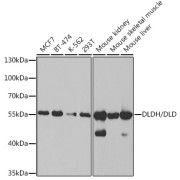 Western blot analysis of various lysates using DLDH/DLD Antibody at 1/1000 dilution. Secondary antibody: HRP-conjugated Goat anti-Rabbit IgG (H+L) at 1/10000 dilution. Lysates/proteins: 25 µg per lane. Blocking buffer: 3% nonfat dry milk in TBST. Detection: ECL Basic Kit (RM00020). Exposure time: 5s.