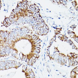 Dihydrolipoyl Dehydrogenase, Mitochondrial (DLD) Antibody