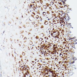 Dihydrolipoyl Dehydrogenase, Mitochondrial (DLD) Antibody
