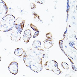 Dihydrolipoyl Dehydrogenase, Mitochondrial (DLD) Antibody