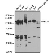 Western blot analysis of various lysates using [KO Validated] EEF2K Antibody at 1/1000 dilution. Secondary antibody: HRP-conjugated Goat anti-Rabbit IgG (H+L) at 1/10000 dilution. Lysates/proteins: 25 µg per lane. Blocking buffer: 3% nonfat dry milk in TBST. Exposure time: 40s.