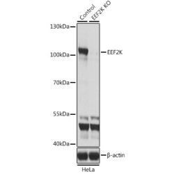 Eukaryotic Elongation Factor 2 Kinase (EEF2K) Antibody