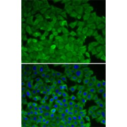 Eukaryotic Elongation Factor 2 Kinase (EEF2K) Antibody