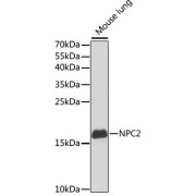 Western blot analysis of lysates from mouse lung, using NPC2 Antibody at 1/1000 dilution. Secondary antibody: HRP-conjugated Goat anti-Rabbit IgG (H+L) at 1/10000 dilution. Lysates/proteins: 25 µg per lane. Blocking buffer: 3% nonfat dry milk in TBST. Exposure time: 90s.