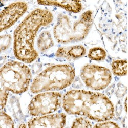 NPC Intracellular Cholesterol Transporter 2 (NPC2) Antibody