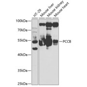 Western blot analysis of various lysates, using PCCB Antibody at 1/2000 dilution. Secondary antibody: HRP-conjugated Goat anti-Rabbit IgG (H+L) at 1/10000 dilution. Lysates/proteins: 25 µg per lane. Blocking buffer: 3% nonfat dry milk in TBST. Exposure time: 60s.
