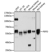 Western blot analysis of various lysates using PEPD Antibody at 1/1000 dilution. Secondary antibody: HRP-conjugated Goat anti-Rabbit IgG (H+L) at 1/10000 dilution. Lysates/proteins: 25 µg per lane. Blocking buffer: 3% nonfat dry milk in TBST. Exposure time: 3s.