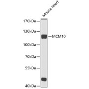 Western blot analysis of lysates from mouse heart, using MCM10 Antibody at 1/1000 dilution. Secondary antibody: HRP-conjugated Goat anti-Rabbit IgG (H+L) at 1/10000 dilution. Lysates/proteins: 25 µg per lane. Blocking buffer: 3% nonfat dry milk in TBST. Exposure time: 30s.