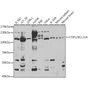 Western blot analysis of various lysates using CTIP1/BCL11A Antibody at 1/1000 dilution. Secondary antibody: HRP-conjugated Goat anti-Rabbit IgG (H+L) at 1/10000 dilution. Lysates/proteins: 25 µg per lane. Blocking buffer: 3% nonfat dry milk in TBST.