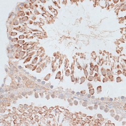 Kinesin-Like Protein KIF2C (KIF2C) Antibody