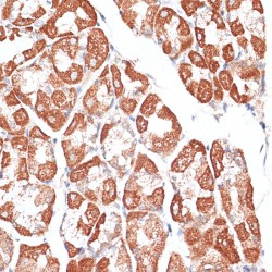 Kinesin-Like Protein KIF2C (KIF2C) Antibody