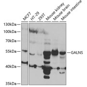 Western blot analysis of various lysates using GALNS Antibody at 1/1000 dilution. Secondary antibody: HRP-conjugated Goat anti-Rabbit IgG (H+L) at 1/10000 dilution. Lysates/proteins: 25 µg per lane. Blocking buffer: 3% nonfat dry milk in TBST. Exposure time: 15s.