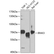 Western blot analysis of various lysates using IRAK3 Antibody at 1/1000 dilution. Secondary antibody: HRP-conjugated Goat anti-Rabbit IgG (H+L) at 1/10000 dilution. Lysates/proteins: 25 µg per lane. Blocking buffer: 3% nonfat dry milk in TBST. Exposure time: 90s.