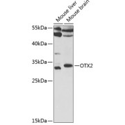 Western blot analysis of various lysates using OTX2 Antibody at 1/1000 dilution. Secondary antibody: HRP-conjugated Goat anti-Rabbit IgG (H+L) at 1/10000 dilution. Lysates/proteins: 25 µg per lane. Blocking buffer: 3% nonfat dry milk in TBST. Exposure time: 60s.
