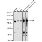Western blot analysis of various lysates using PFKM Antibody at 1/1000 dilution. Secondary antibody: HRP-conjugated Goat anti-Rabbit IgG (H+L) at 1/10000 dilution. Lysates/proteins: 25 µg per lane. Blocking buffer: 3% nonfat dry milk in TBST. Exposure time: 1s.