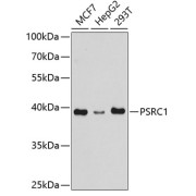 Western blot analysis of various lysates using PSRC1 Antibody at 1/1000 dilution. Secondary antibody: HRP-conjugated Goat anti-Rabbit IgG (H+L) at 1/10000 dilution. Lysates / proteins: 25 µg per lane. Blocking buffer: 3 % nonfat dry milk in TBST. Detection: ECL Basic Kit (RM00020). Exposure time: 90s.