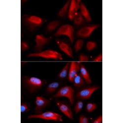 S100 Calcium Binding Protein A11 (S100A11) Antibody