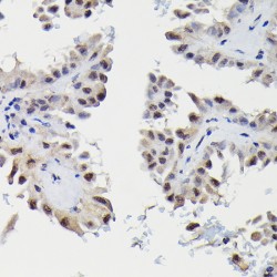 Small Nuclear Ribonucleoprotein E (SNRPE) Antibody