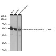 Western blot analysis of various lysates using Thioredoxin reductase 2 (TXNRD2 ) Antibody at 1/1000 dilution. Secondary antibody: HRP-conjugated Goat anti-Rabbit IgG (H+L) at 1/10000 dilution. Lysates/proteins: 25 µg per lane. Blocking buffer: 3% nonfat dry milk in TBST. Exposure time: 90s.