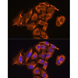 Thioredoxin Reductase 2 (TXNRD2) Antibody