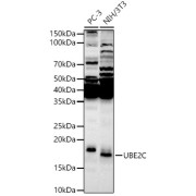 Western blot analysis of various lysates, using UBE2C Antibody at 1/500 dilution. Secondary antibody: HRP-conjugated Goat anti-Rabbit IgG (H+L) at 1/10000 dilution. Lysates/proteins: 25 µg per lane. Blocking buffer: 3% nonfat dry milk in TBST. Exposure time: 90s.