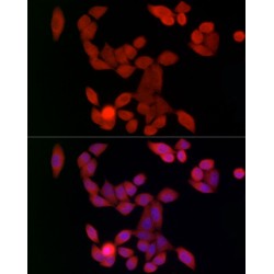 Ubiquitin Conjugating Enzyme E2C (UBE2C) Antibody