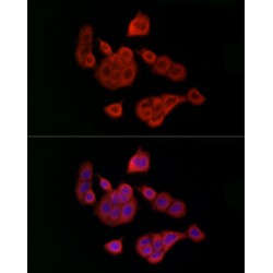 Ubiquitin Conjugating Enzyme E2C (UBE2C) Antibody