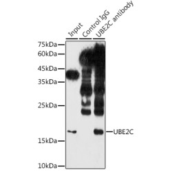 Ubiquitin Conjugating Enzyme E2C (UBE2C) Antibody