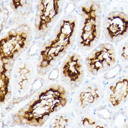 Neutral and Basic Amino Acid Transport Protein rBAT (SLC3A1) Antibody