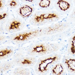 Neutral and Basic Amino Acid Transport Protein rBAT (SLC3A1) Antibody