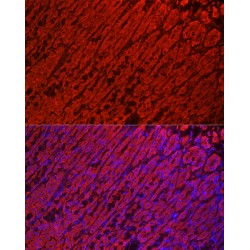 Aldehyde Dehydrogenase 3 Family Member A1 (ALDH3A1) Antibody