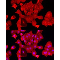 Aldehyde Dehydrogenase 3 Family Member A1 (ALDH3A1) Antibody