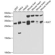 abx004221