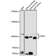 Western blot analysis of various lysates using PKP2 Antibody at 1/1000 dilution. Secondary antibody: HRP-conjugated Goat anti-Rabbit IgG (H+L) at 1/10000 dilution. Lysates/proteins: 25 µg per lane. Blocking buffer: 3% nonfat dry milk in TBST. Exposure time: 10s.