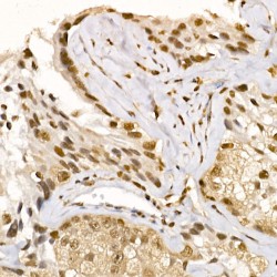 RAC-Alpha Serine/threonine-Protein Kinase (AKT1) Antibody