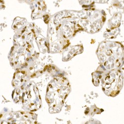 RAC-Alpha Serine/threonine-Protein Kinase (AKT1) Antibody