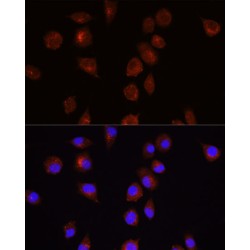 RAC-Alpha Serine/threonine-Protein Kinase (AKT1) Antibody