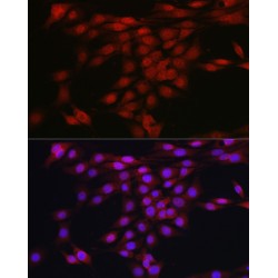 RAC-Alpha Serine/threonine-Protein Kinase (AKT1) Antibody