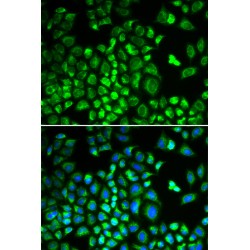 HCLS1-Associated Protein X-1 (HAX1) Antibody