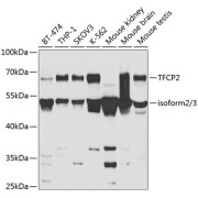 Western blot analysis of various lysates using TFCP2 Antibody at 1/1000 dilution. Secondary antibody: HRP-conjugated Goat anti-Rabbit IgG (H+L) at 1/10000 dilution. Lysates/proteins: 25 µg per lane. Blocking buffer: 3% nonfat dry milk in TBST. Detection: ECL Basic Kit (RM00020). Exposure time: 5s.
