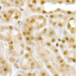 Ring Finger Protein 2 (RNF2) Antibody
