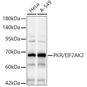Western blot analysis of various lysates, using PKR/EIF2AK2 Antibody at 1/1000 dilution. Secondary antibody: HRP-conjugated Goat anti-Rabbit IgG (H+L) at 1/10000 dilution. Lysates/proteins: 25 µg per lane. Blocking buffer: 3% nonfat dry milk in TBST. Exposure time: 0.3s.