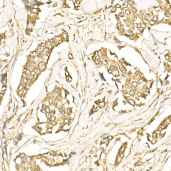 Microtubule-Associated Proteins 1A/1B Light Chain 3B (MAP1LC3B) Antibody