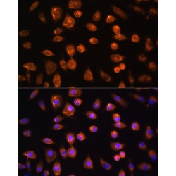 Vascular Endothelial Growth Factor Receptor 3 (FLT4) Antibody