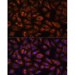 Vascular Endothelial Growth Factor Receptor 3 (FLT4) Antibody